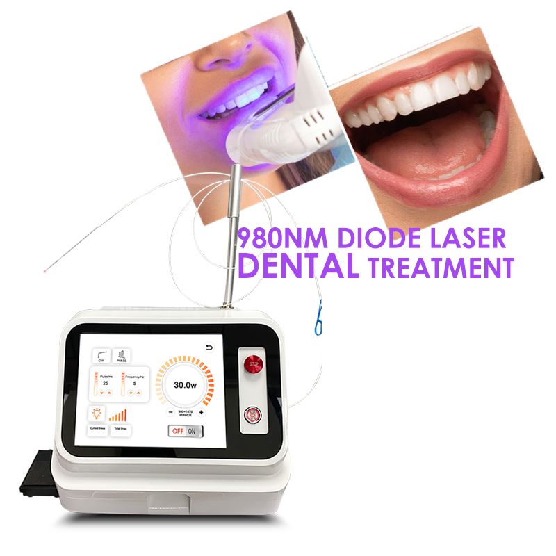 2024 Dispositivo Laser per Tes - Teeth Whitening With Laser recensione e prezzo