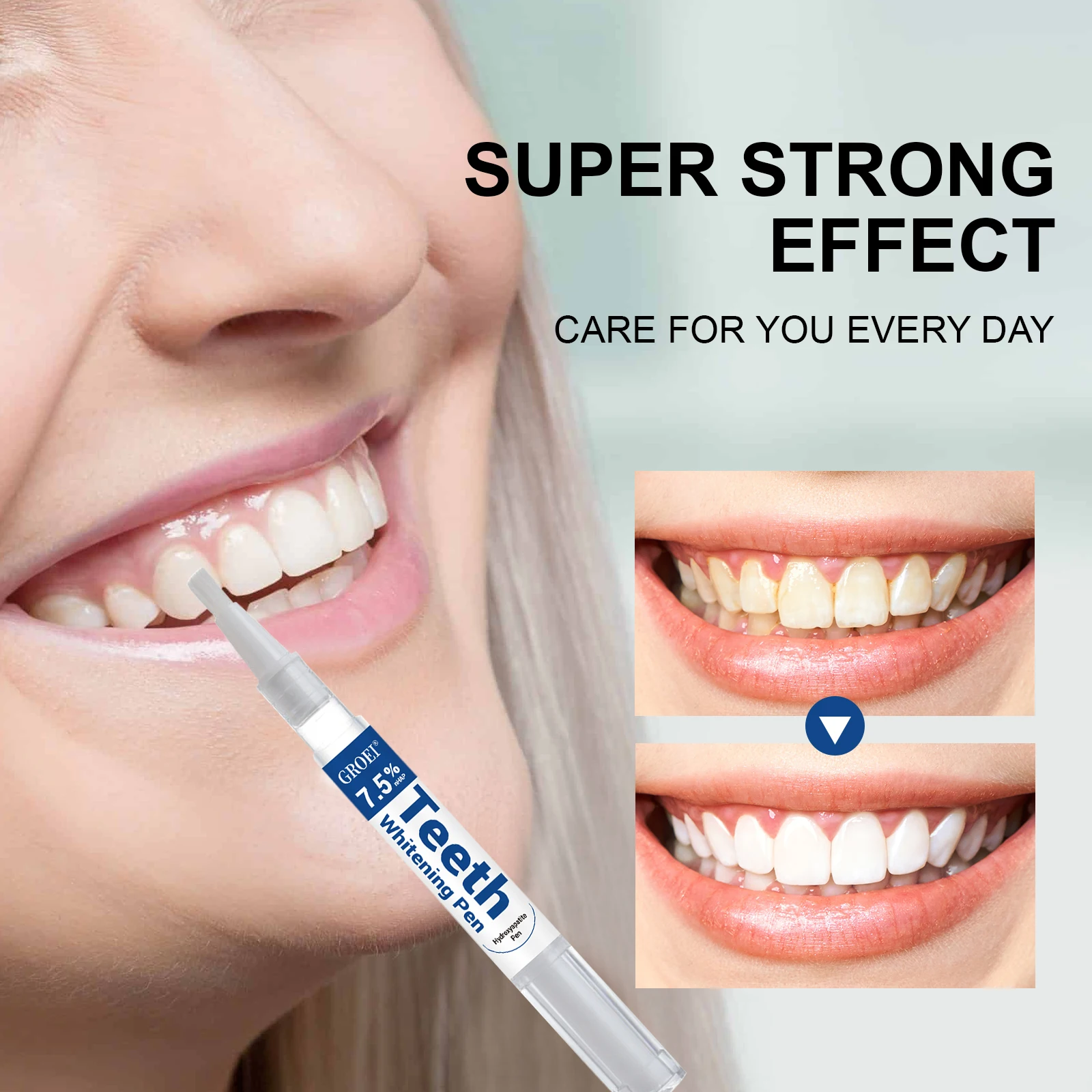 Penna per sbiancamento dei den - Teeth Whitening Hydrogen Peroxide recensione e prezzo