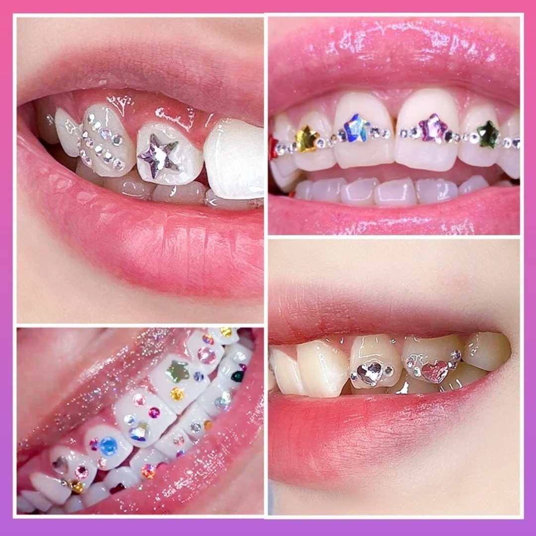 Kit di gemme per denti fai-da- - Tooth Gem Kit recensione e prezzo