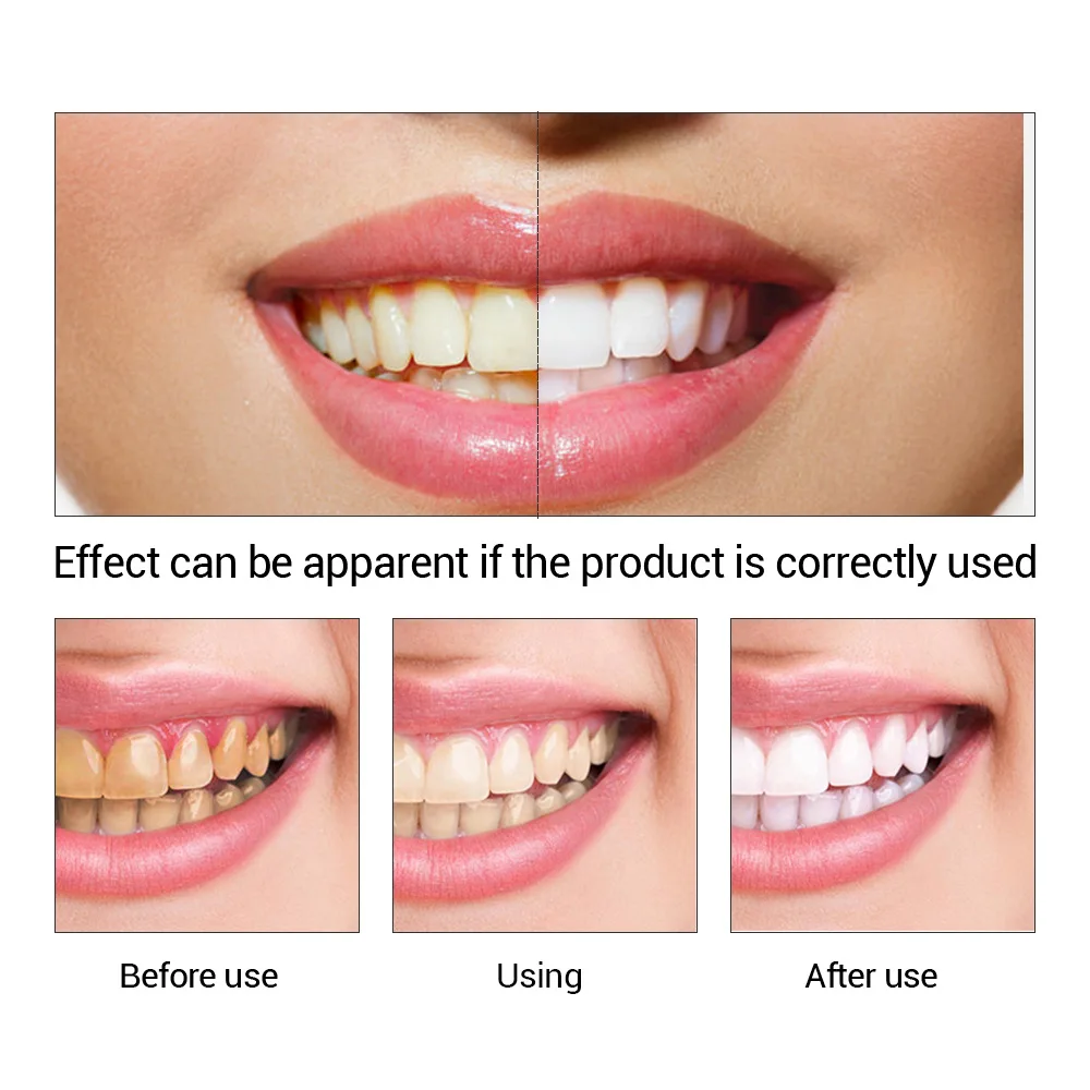 FTEENPLY Sbiancamento Dei Dent - Teeth Whitening Paste recensione e prezzo
