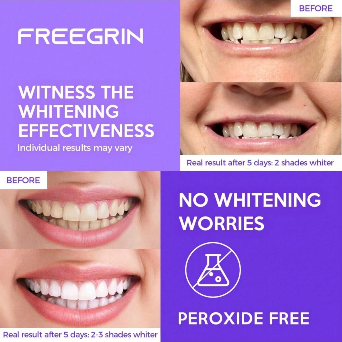 Adesivi sbiancanti per denti d - Teeth Whitening Hydrogen Peroxide recensione e prezzo